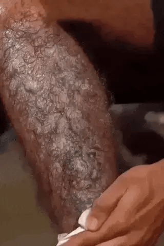 Hair Removal Spray